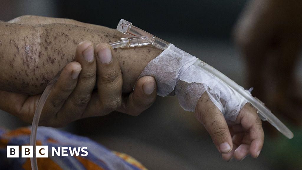 Hundreds of children die within months as measles cases soar in Bangladesh 604452f0 5967 11f1 8e96 b3dc9dcf44fd.jpg
