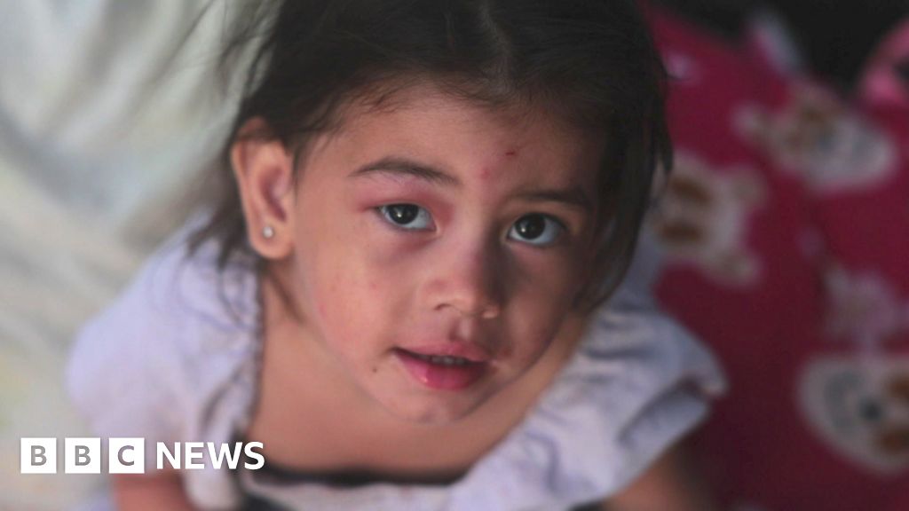 Venezuela earthquakes: Inside the country club now a makeshift hospital 19bd1460 7317 11f1 8546 8f19e4fe30f4.jpg